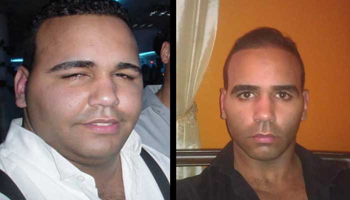 face weight loss before and after 2