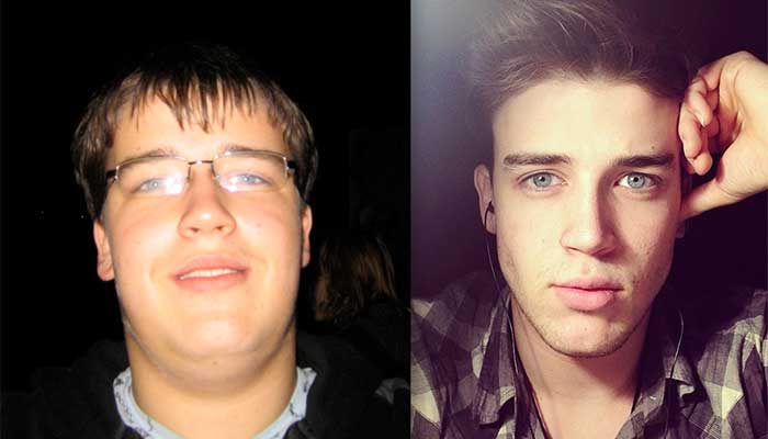 lose weight on face before and after