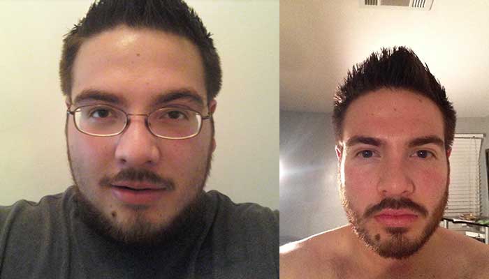 face weight loss before and after 6